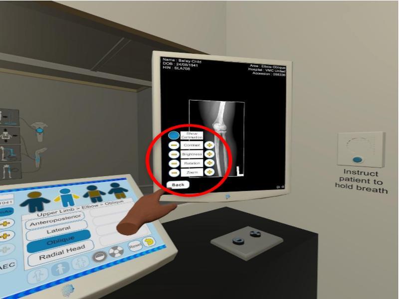 Radiograph on screen with the adjustment menu and Deviation Index