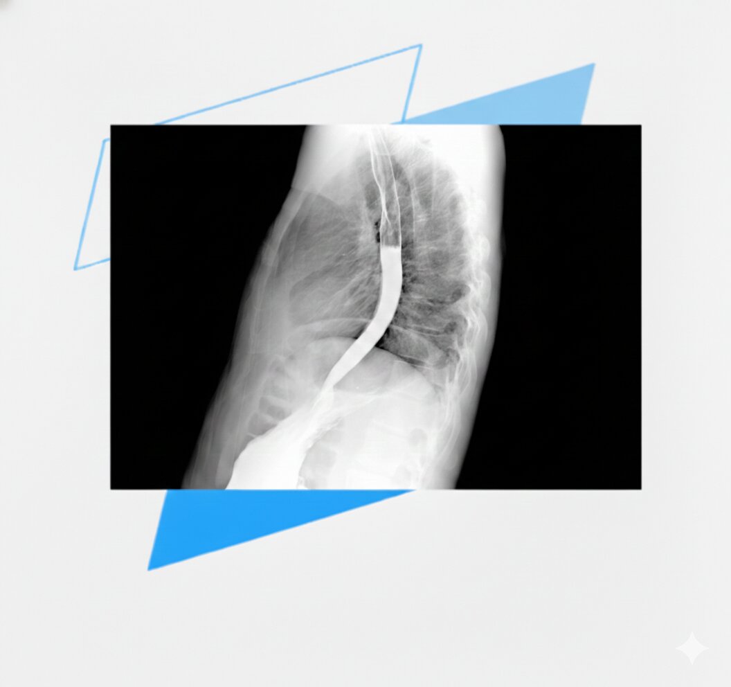 Barium swallow Barium swallow